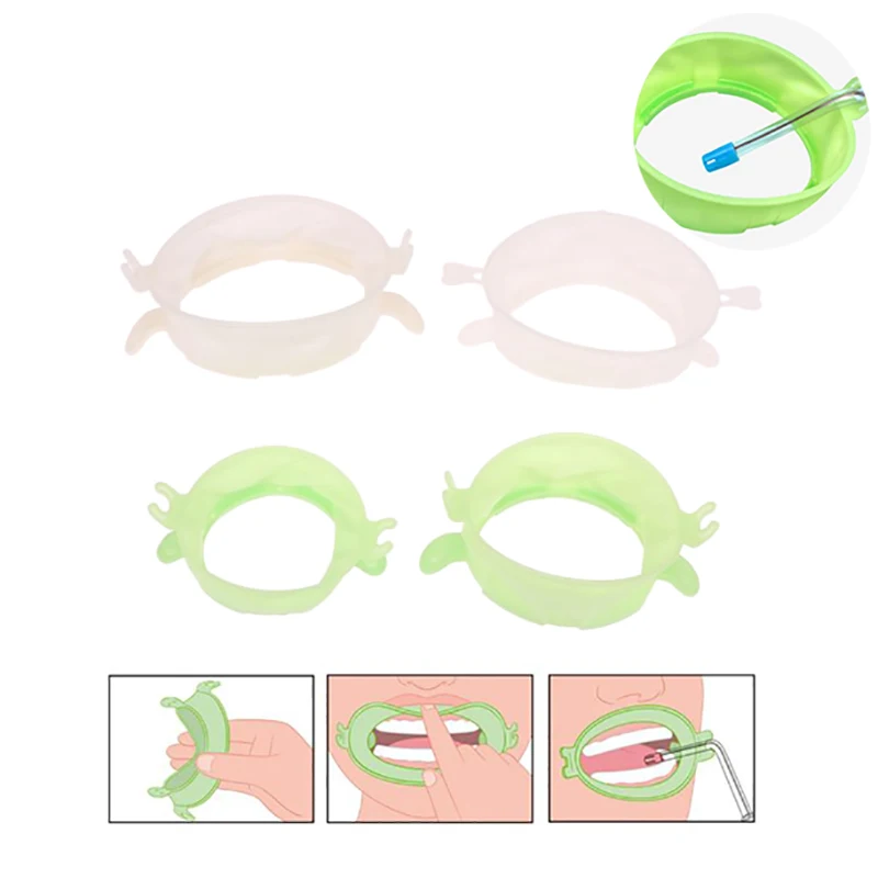 Teeth Whitening Accelerator - 3Pcs S/M/L Dental Lip Cheek Retractor