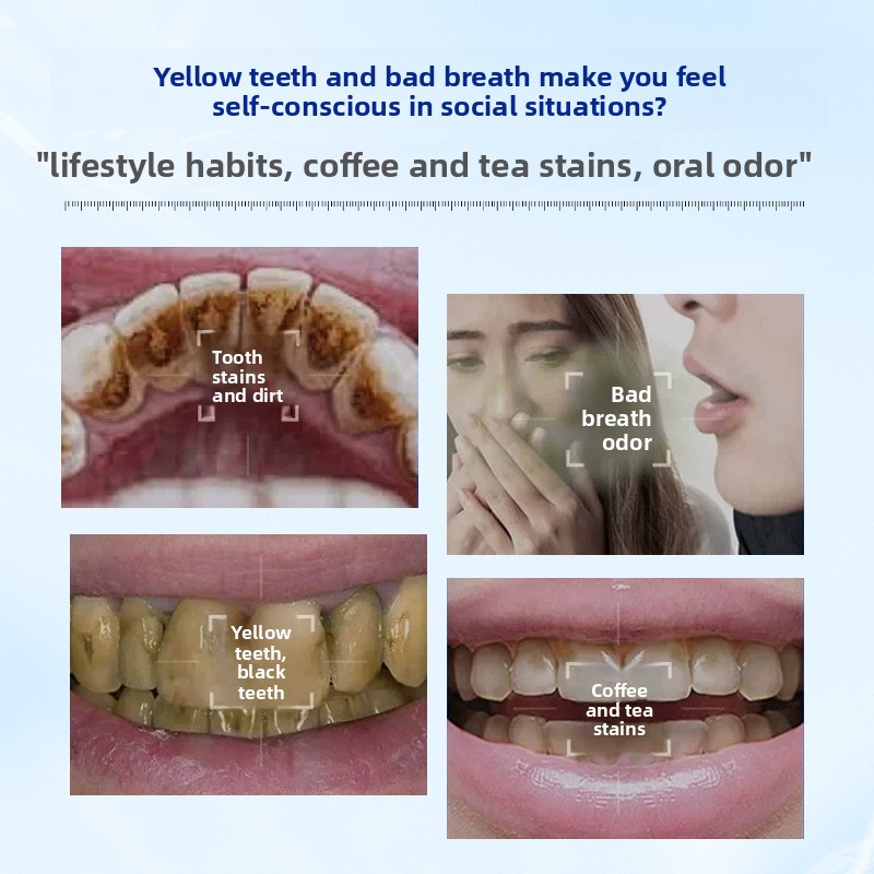 Enzyme Brightening and Whiteni - Teeth Whitening Enzymes 评论和价格