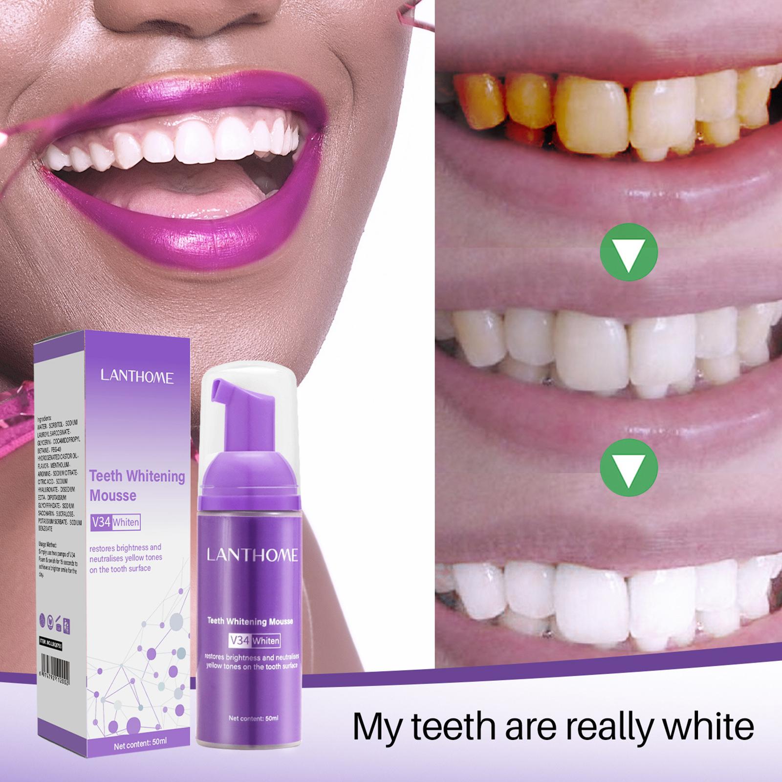 50MLTeeth Whitening Mousse Rem - Teeth Whitening Foam Toothpaste 评论和价格
