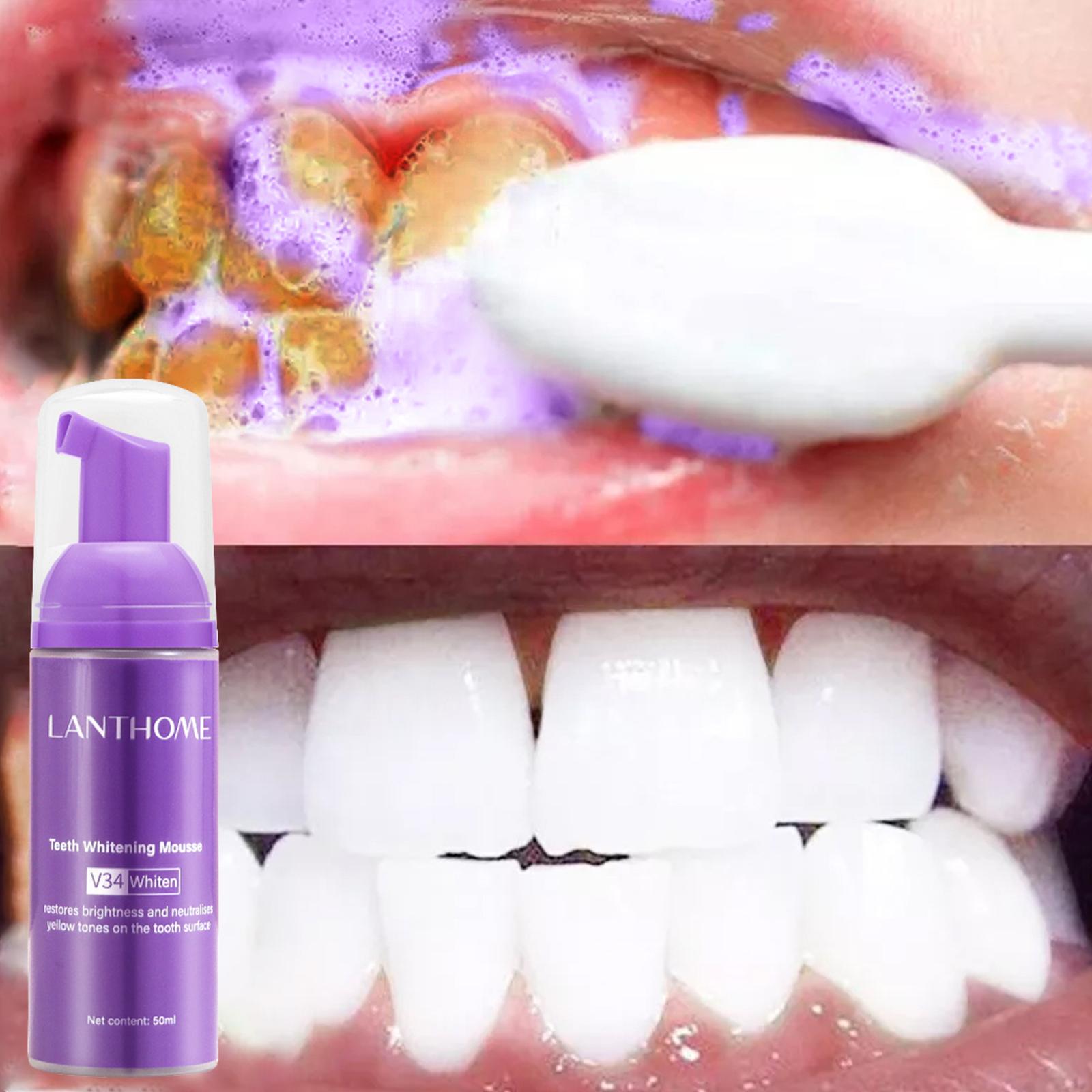 50MLTeeth Whitening Mousse Rem - Teeth Whitening Foam Toothpaste 评论和价格