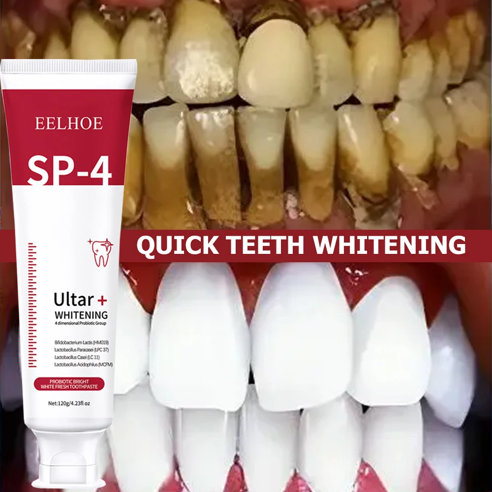 5pcs Sp-4 120g Probiotic White - Teeth Whitening Enzymes 评论和价格