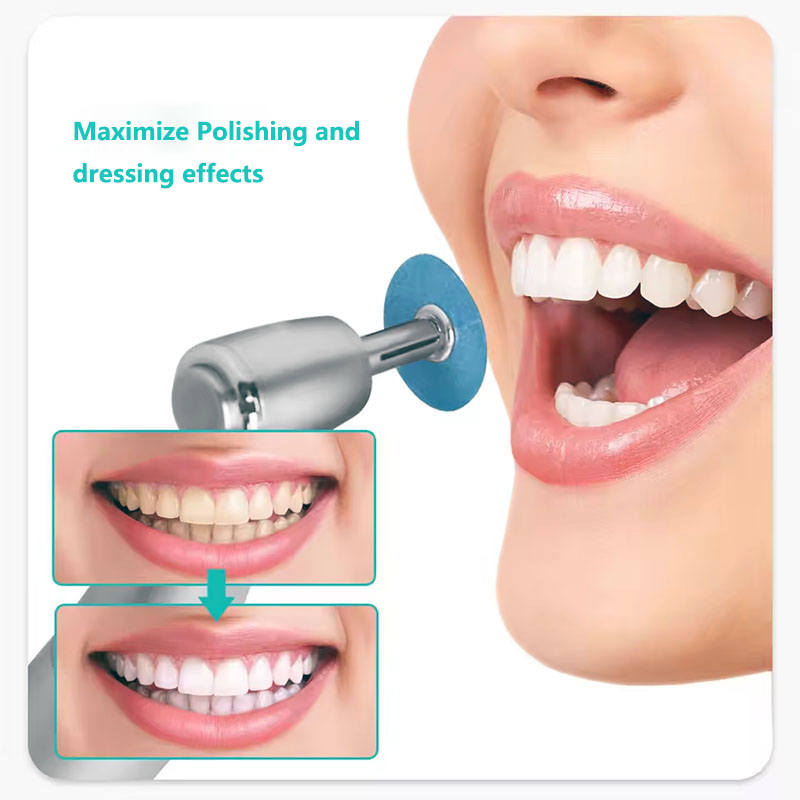 40pcs Dental Polishing Discs H - Teeth Whitening Express 评论和价格