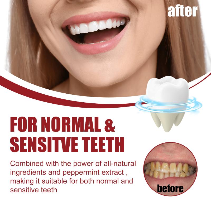SP-5 Probiotic Toothpaste Whit - Teeth Whitening Foam Toothpaste 评论和价格