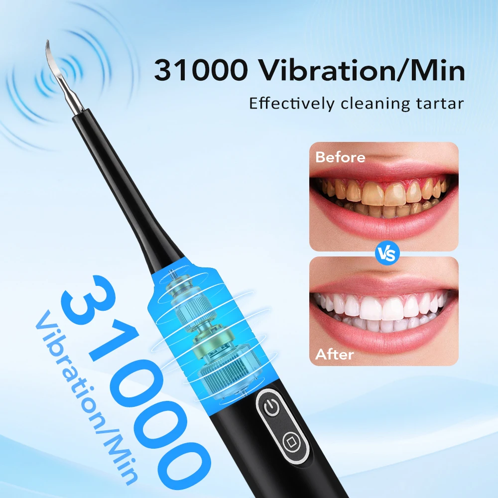 Electric Sonic Vibration Denta - Teeth Whitening Express 评论和价格